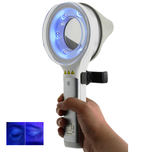 Skin Disorder  Depigmentation  – обзор и цена Led Medical Headlight